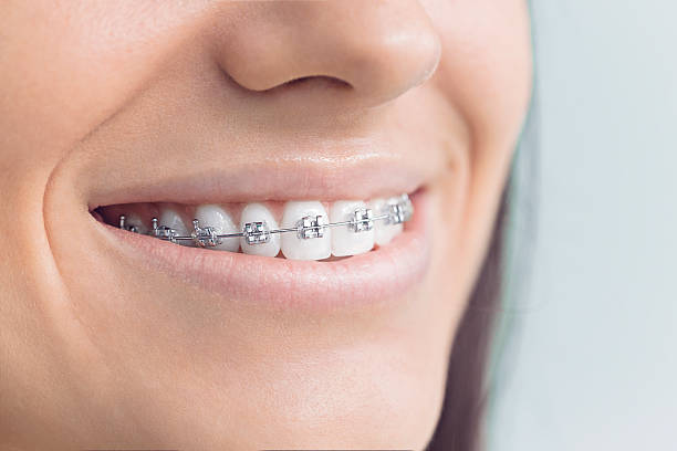 Best Full Mouth Reconstruction  in South Jacksonvle, IL